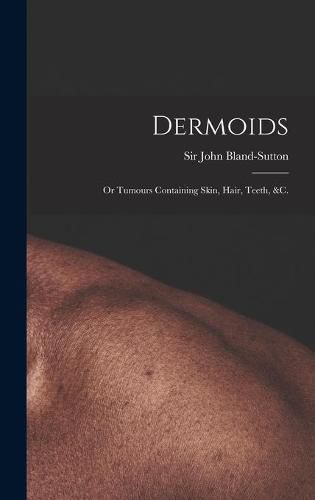 Cover image for Dermoids: or Tumours Containing Skin, Hair, Teeth, &c.