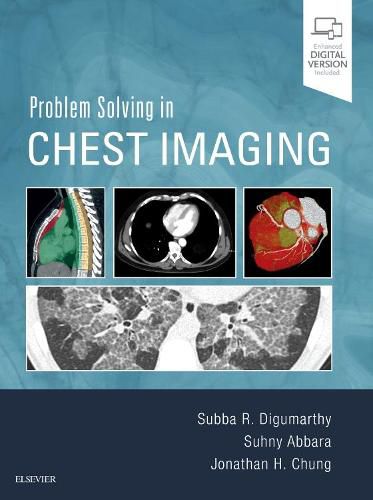 Cover image for Problem Solving in Chest Imaging