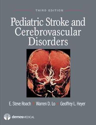 Cover image for Pediatric Stroke and Cerebrovascular Disorders