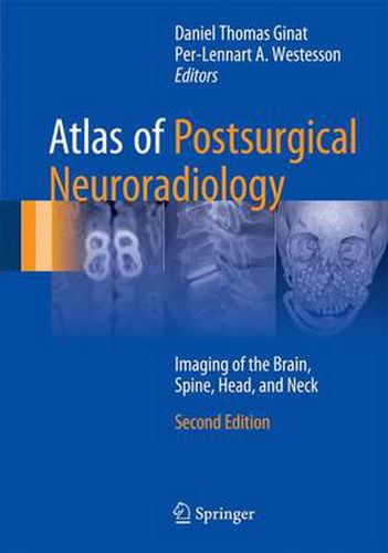 Cover image for Atlas of Postsurgical Neuroradiology: Imaging of the Brain, Spine, Head, and Neck