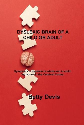 Cover image for Dyslexic Brain of a Child or Adult: Symptoms of dyslexia in adults and in child: Variations in the Cerebral Cortex.