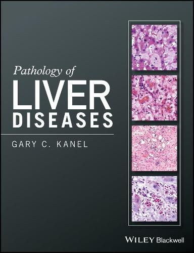 Cover image for Pathology of Liver Diseases