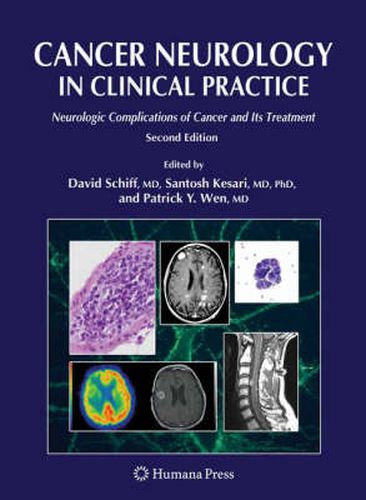 Cover image for Cancer Neurology in Clinical Practice: Neurologic Complications of Cancer and Its Treatment