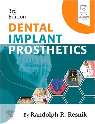 Cover image for Dental Implant Prosthetics