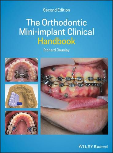 Cover image for The Orthodontic Mini-implant Clinical Handbook 2nd  Edition