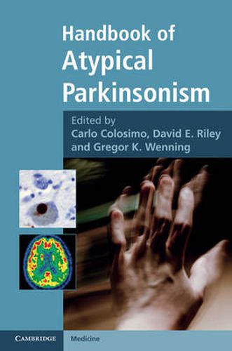 Handbook of Atypical Parkinsonism