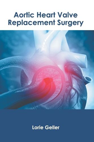 Cover image for Aortic Heart Valve Replacement Surgery