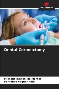 Cover image for Dental Coronectomy