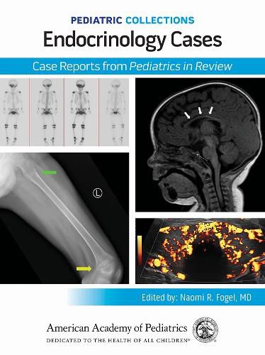 Cover image for Endocrinology Cases