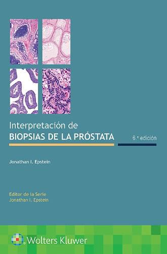 Cover image for Interpretacion de biopsias de la prostata