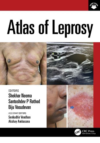 Cover image for Atlas of Leprosy