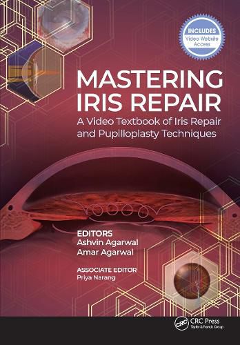 Cover image for Mastering Iris Repair: A Video Textbook of Iris Repair and Pupilloplasty Techniques