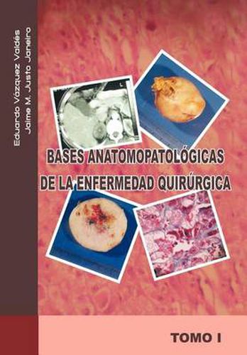 Cover image for Bases Anatomopatologicas de La Enfermedad Quirurgica