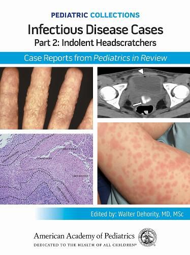 Cover image for Infectious Disease Cases: Part 2: Indolent Head Scratchers