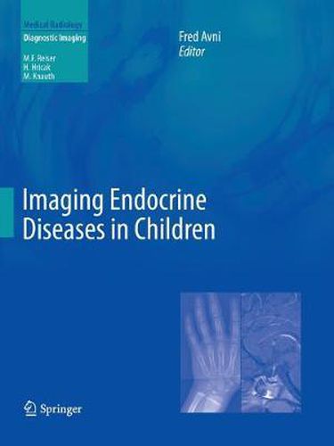 Cover image for Imaging Endocrine Diseases in Children