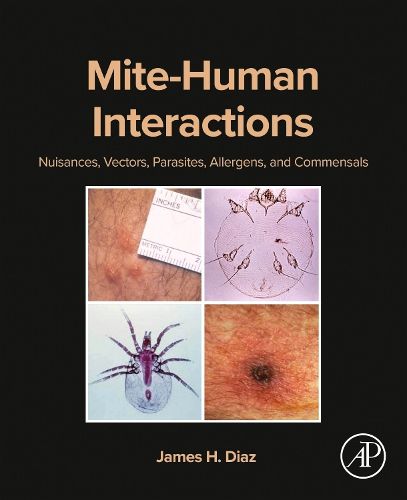 Mite-Human Interactions