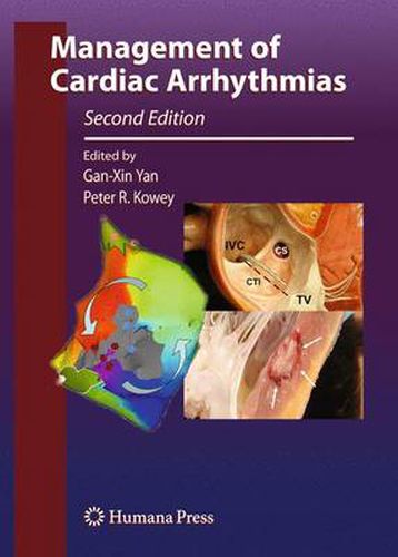 Management of Cardiac Arrhythmias