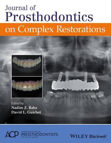 Cover image for Journal of Prosthodontics on Complex Restorations