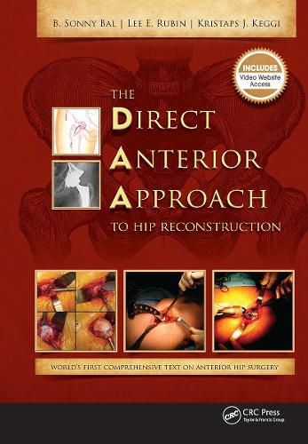 Cover image for The Direct Anterior Approach to Hip Reconstruction