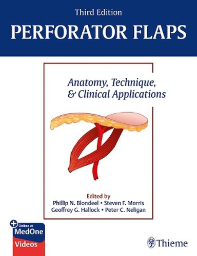 Cover image for Perforator Flaps