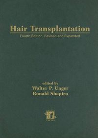 Cover image for Hair Transplantation, Fourth Edition