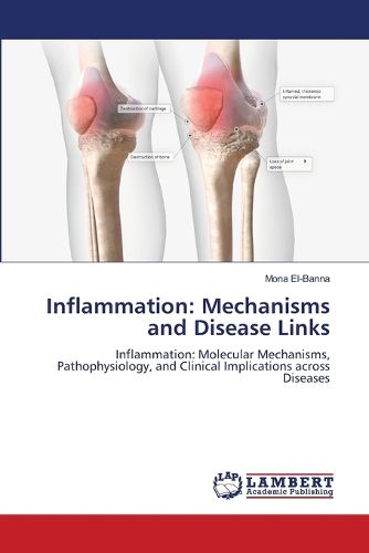 Cover image for Inflammation