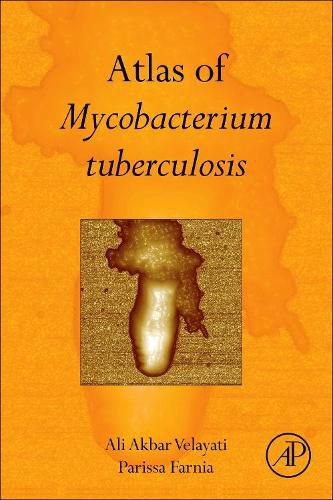 Cover image for Atlas of Mycobacterium Tuberculosis