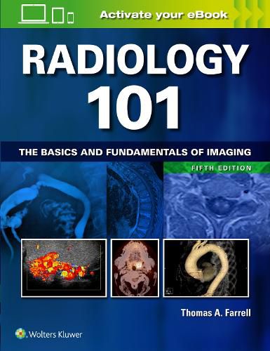 Cover image for Radiology 101: The Basics and Fundamentals of Imaging