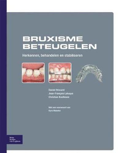 Cover image for Bruxisme Beteugelen: Herkennen, Behandelen En Stabiliseren