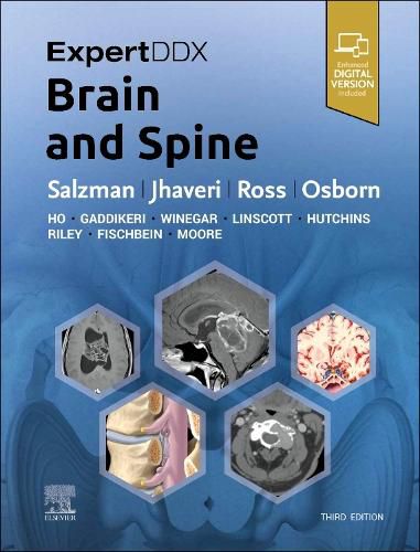 Cover image for ExpertDDx: Brain and Spine