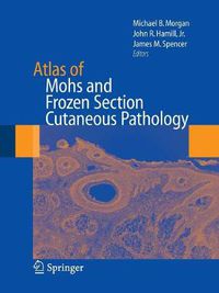 Cover image for Atlas of Mohs and Frozen Section Cutaneous Pathology