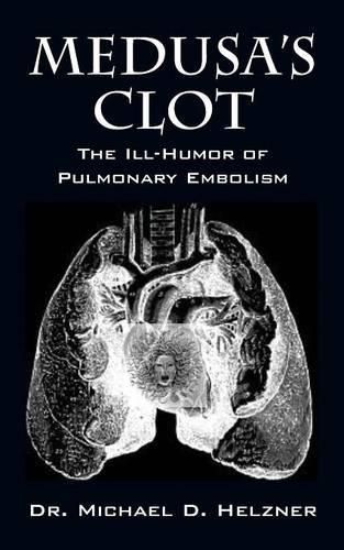 Cover image for Medusa's Clot: The Ill-Humor of Pulmonary Embolism