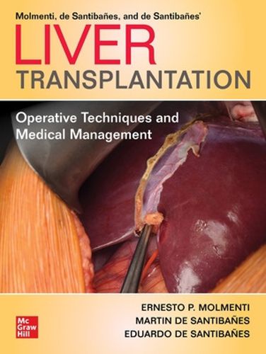 Cover image for Liver Transplantation: Operative Techniques and Medical Management