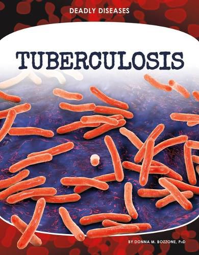 Cover image for Tuberculosis