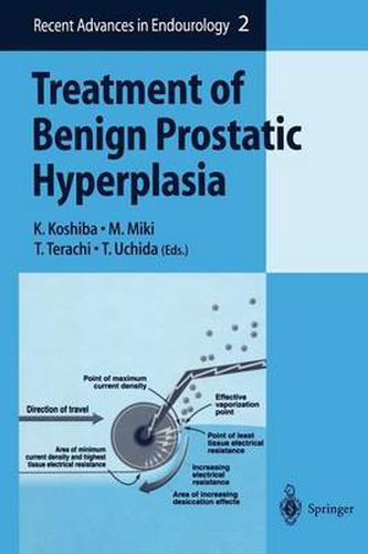 Cover image for Treatment of Benign Prostatic Hyperplasia