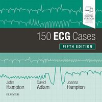 Cover image for 150 ECG Cases