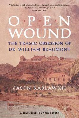 Open Wound: The Tragic Obsession of Dr. William Beaumont