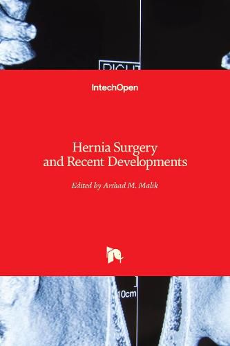 Cover image for Hernia Surgery and Recent Developments