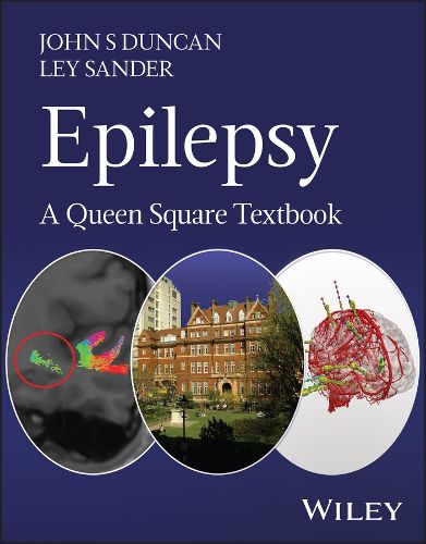 Cover image for Epilepsy