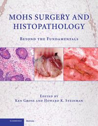 Cover image for Mohs Surgery and Histopathology: Beyond the Fundamentals