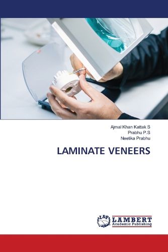 Cover image for Laminate Veneers