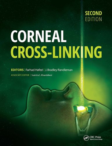 Cover image for Corneal Cross-Linking