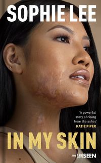 Cover image for In My Skin