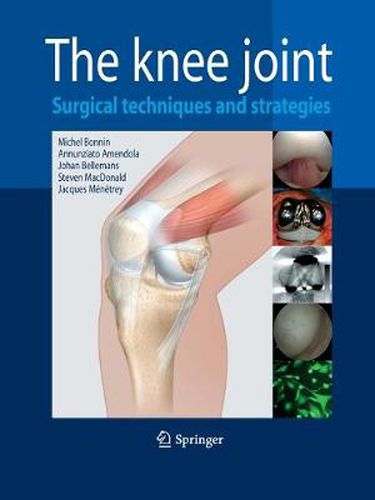 The Knee Joint: Surgical Techniques and Strategies