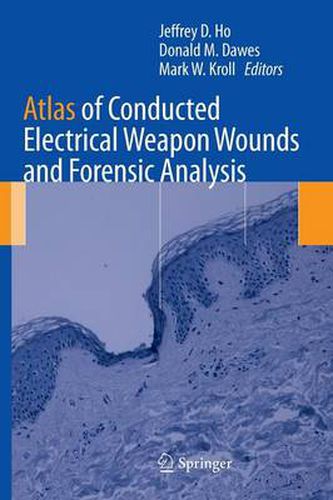 Cover image for Atlas of Conducted Electrical Weapon Wounds and Forensic Analysis