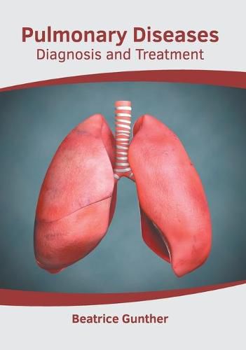 Cover image for Pulmonary Diseases: Diagnosis and Treatment