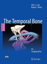 Cover image for Temporal Bone: An Imaging Atlas