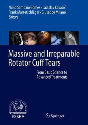 Cover image for Massive and Irreparable Rotator Cuff Tears: From Basic Science to Advanced Treatments