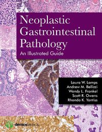 Cover image for Neoplastic Gastrointestinal Pathology: An Illustrated Guide