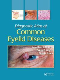 Cover image for Diagnostic Atlas of Common Eyelid Diseases